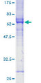 RNF126 Protein - 12.5% SDS-PAGE of human RNF126 stained with Coomassie Blue