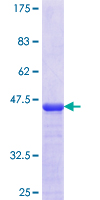 RNF128 / GRAIL Protein - 12.5% SDS-PAGE Stained with Coomassie Blue.