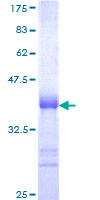 RNF13 Protein - 12.5% SDS-PAGE Stained with Coomassie Blue.
