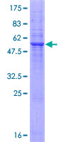 RNF130 Protein - 12.5% SDS-PAGE of human RNF130 stained with Coomassie Blue