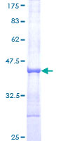 RNF130 Protein - 12.5% SDS-PAGE Stained with Coomassie Blue.