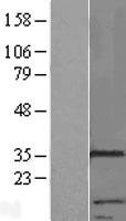 RNF133 Protein - Western validation with an anti-DDK antibody * L: Control HEK293 lysate R: Over-expression lysate