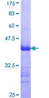 RNF133 Protein - 12.5% SDS-PAGE Stained with Coomassie Blue.