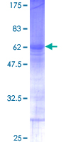 RNF138 Protein - 12.5% SDS-PAGE of human RNF138 stained with Coomassie Blue