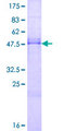 RNF138 Protein - 12.5% SDS-PAGE of human RNF138 stained with Coomassie Blue