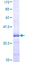 RNF138 Protein - 12.5% SDS-PAGE Stained with Coomassie Blue.