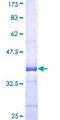 RNF138 Protein - 12.5% SDS-PAGE Stained with Coomassie Blue.