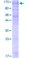 RNF139 / TRC8 Protein - 12.5% SDS-PAGE of human RNF139 stained with Coomassie Blue