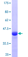 RNF139 / TRC8 Protein - 12.5% SDS-PAGE Stained with Coomassie Blue.