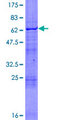 RNF14 / ARA54 Protein - 12.5% SDS-PAGE of human RNF14 stained with Coomassie Blue
