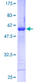 RNF141 Protein - 12.5% SDS-PAGE of human RNF141 stained with Coomassie Blue
