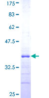 RNF141 Protein - 12.5% SDS-PAGE Stained with Coomassie Blue.