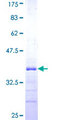 RNF141 Protein - 12.5% SDS-PAGE Stained with Coomassie Blue.