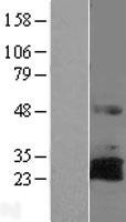RNF144A / RNF144 Protein - Western validation with an anti-DDK antibody * L: Control HEK293 lysate R: Over-expression lysate