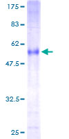 RNF144A / RNF144 Protein - 12.5% SDS-PAGE of human RNF144 stained with Coomassie Blue