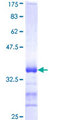 RNF144B Protein - 12.5% SDS-PAGE Stained with Coomassie Blue.