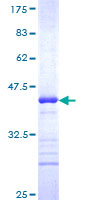 RNF145 Protein - 12.5% SDS-PAGE Stained with Coomassie Blue.