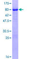RNF146 Protein - 12.5% SDS-PAGE of human RNF146 stained with Coomassie Blue