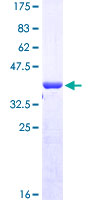 RNF146 Protein - 12.5% SDS-PAGE Stained with Coomassie Blue.