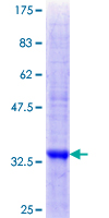 RNF148 Protein - 12.5% SDS-PAGE Stained with Coomassie Blue.