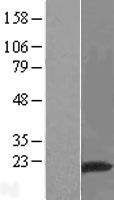 RNF149 Protein - Western validation with an anti-DDK antibody * L: Control HEK293 lysate R: Over-expression lysate