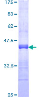 RNF150 Protein - 12.5% SDS-PAGE Stained with Coomassie Blue.