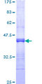 RNF150 Protein - 12.5% SDS-PAGE Stained with Coomassie Blue.