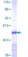 RNF151 Protein - 12.5% SDS-PAGE Stained with Coomassie Blue.