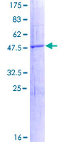 RNF152 Protein - 12.5% SDS-PAGE of human RNF152 stained with Coomassie Blue