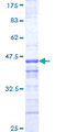 RNF157 Protein - 12.5% SDS-PAGE Stained with Coomassie Blue.