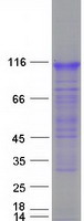 RNF157 Protein - Purified recombinant protein RNF157 was analyzed by SDS-PAGE gel and Coomassie Blue Staining