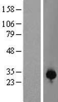 RNF166 Protein - Western validation with an anti-DDK antibody * L: Control HEK293 lysate R: Over-expression lysate