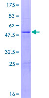 RNF166 Protein - 12.5% SDS-PAGE of human RNF166 stained with Coomassie Blue