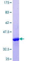 RNF166 Protein - 12.5% SDS-PAGE Stained with Coomassie Blue.