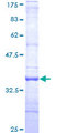 RNF167 Protein - 12.5% SDS-PAGE Stained with Coomassie Blue.