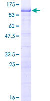 RNF168 Protein - 12.5% SDS-PAGE of human RNF168 stained with Coomassie Blue