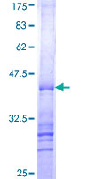 RNF168 Protein - 12.5% SDS-PAGE Stained with Coomassie Blue.