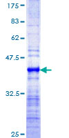 RNF169 Protein - 12.5% SDS-PAGE Stained with Coomassie Blue.