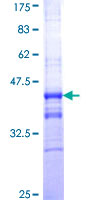 RNF17 Protein - 12.5% SDS-PAGE Stained with Coomassie Blue.