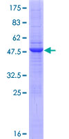 RNF170 Protein - 12.5% SDS-PAGE of human RNF170 stained with Coomassie Blue