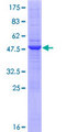 RNF170 Protein - 12.5% SDS-PAGE of human RNF170 stained with Coomassie Blue