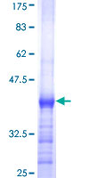 RNF174 / MARCH4 Protein - 12.5% SDS-PAGE Stained with Coomassie Blue.
