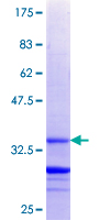 RNF175 Protein - 12.5% SDS-PAGE Stained with Coomassie Blue.