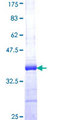 RNF180 Protein - 12.5% SDS-PAGE Stained with Coomassie Blue.