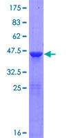 RNF181 Protein - 12.5% SDS-PAGE of human RNF181 stained with Coomassie Blue