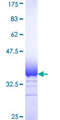 RNF181 Protein - 12.5% SDS-PAGE Stained with Coomassie Blue.