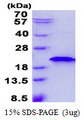 RNF181 Protein