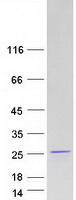 RNF181 Protein - Purified recombinant protein RNF181 was analyzed by SDS-PAGE gel and Coomassie Blue Staining