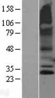 RNF182 Protein - Western validation with an anti-DDK antibody * L: Control HEK293 lysate R: Over-expression lysate