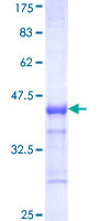 RNF182 Protein - 12.5% SDS-PAGE Stained with Coomassie Blue.